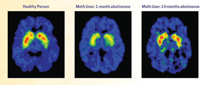 recovery-behavior-post-impact